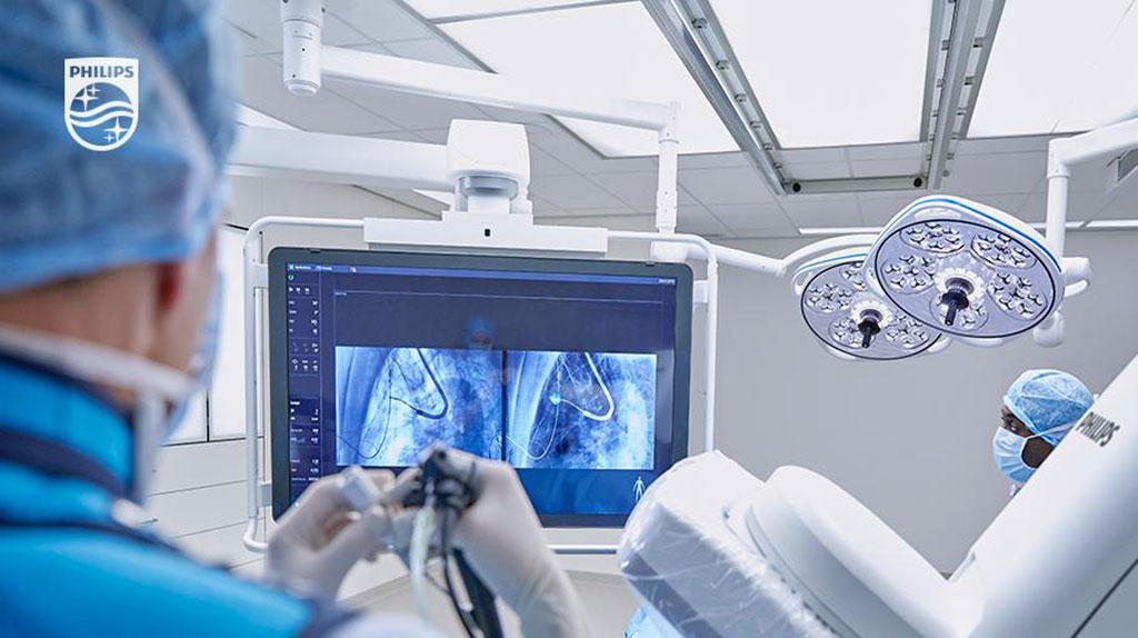 Image: The Azurion Lung Edition combines CBCT 3D images with live IGT X-ray guidance (Photo courtesy of Philips)