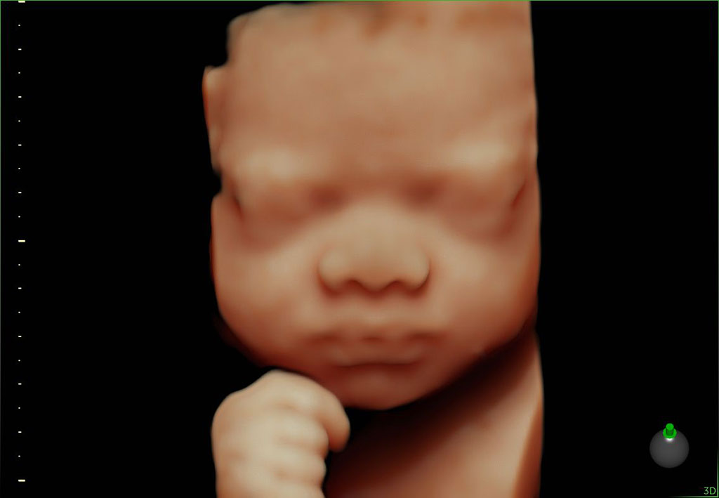 Image: Novel AI algorithms power the Voluson SWIFT OB/GYN ultrasound scanner (Photo courtesy of GE Healthcare)