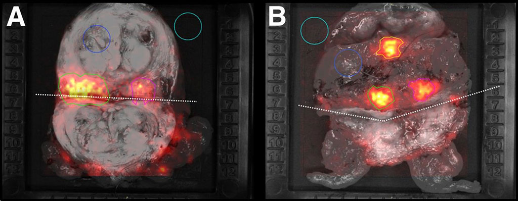 Image: CLI manifesatations on excised tissues (Photo courtesy of Lightpoint Medical)