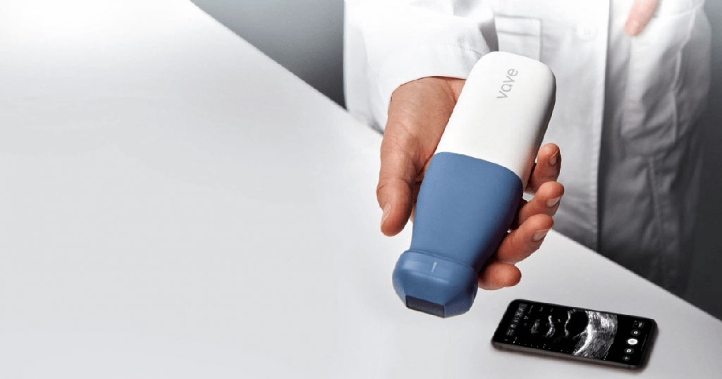 Image: The Vave handheld ultrasound scanner (Photo courtesy of Vave Health)