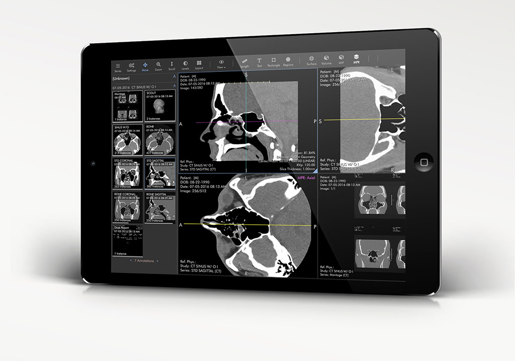 Image: The ProViewer cloud-based diagnostic image viewer (Photo courtesy of Ambra Health)