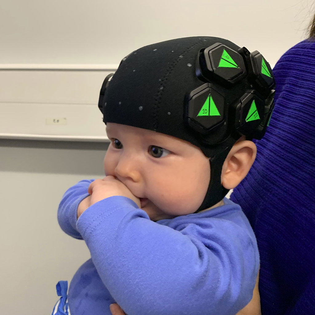 Image: A baby wearing the HD-DOT imaging cap (Photo courtesy of UCL)