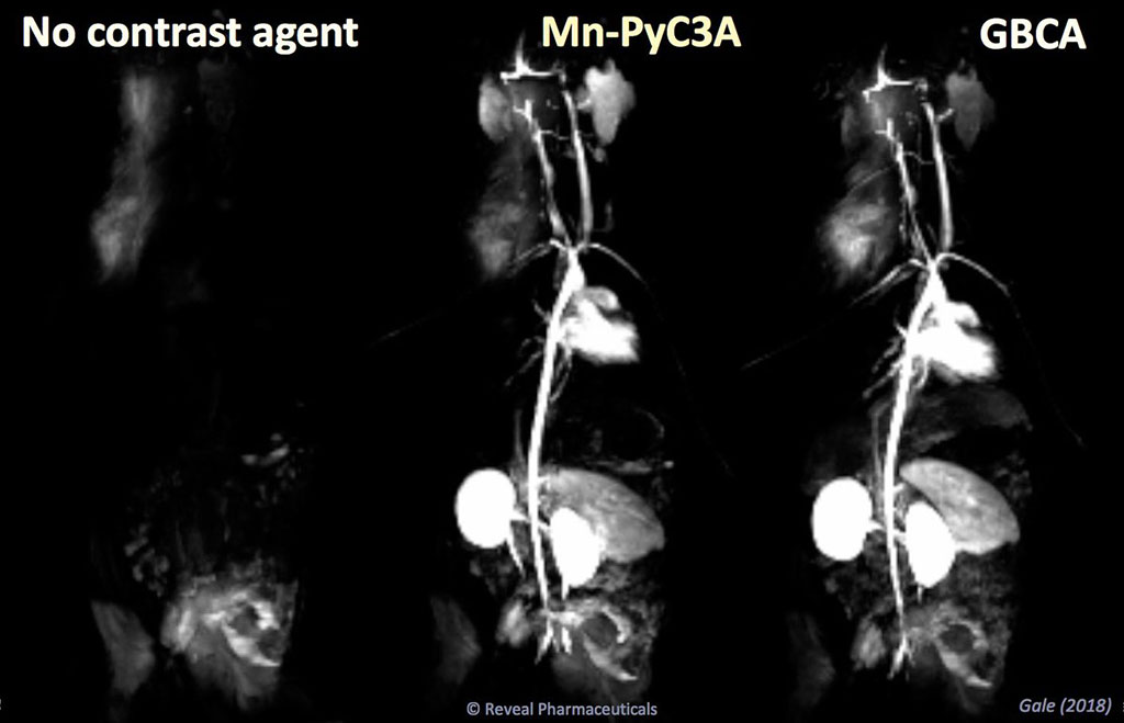 Image: MRI manganese-based contrast agents are as efficient as gadolinium, but less toxic (Photo courtesy of Eric Gale/ MGH)