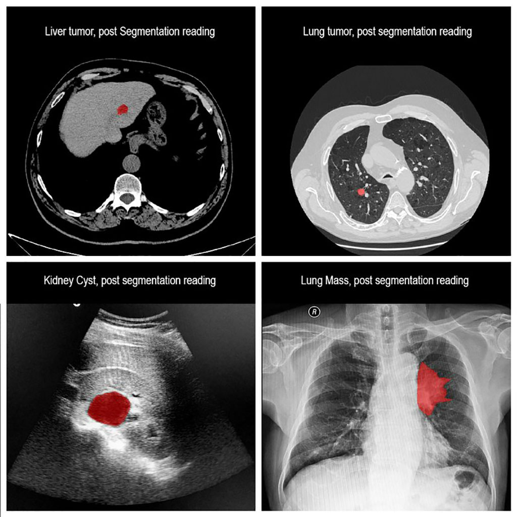 Image: New AI-Based Medical Image Segmentation and Measurement Tool Minimizes Human Errors in Clinical Analysis (Photo courtesy of Business Wire)