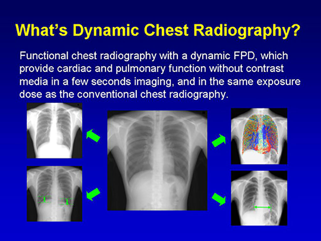 Image: Examples of DCR images (Photo courtesy of Rie Tanaka/ Kanazawa University)