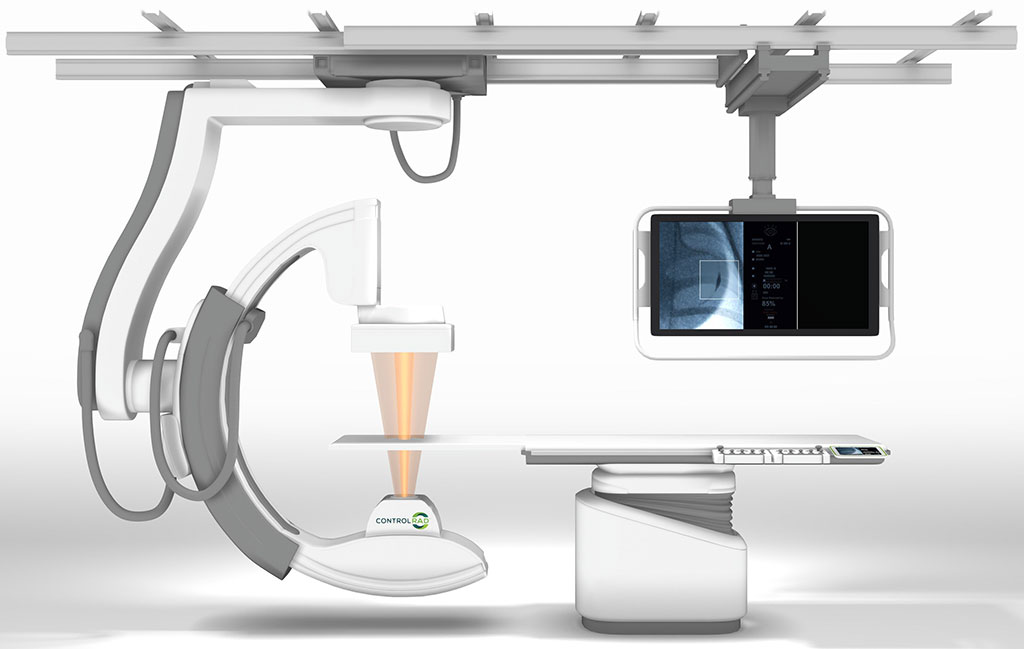 Image: The ControlRad Select optimizes the X-ray beam to reduce radiation by 85% (Photo courtesy of ControlRad)