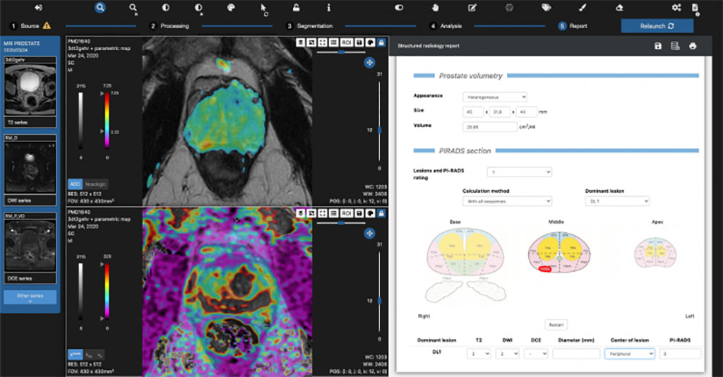 Image: The qp-Prostate suite dashboard (Photo courtesy of Quibim)