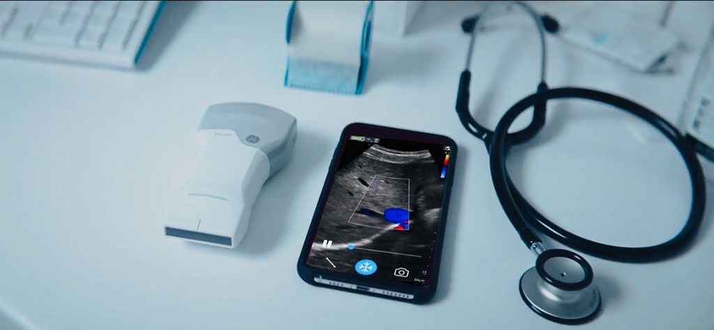 Image: The GE Healthcare Vscan Air probe and app (Photo courtesy of GE Healthcare)