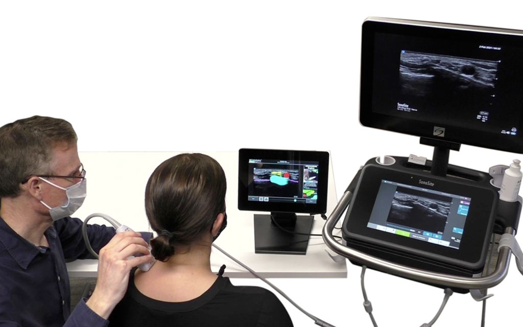 Image: The ScanNav Anatomy PNB (center) (Photo courtesy of Intelligent Ultrasound Group)