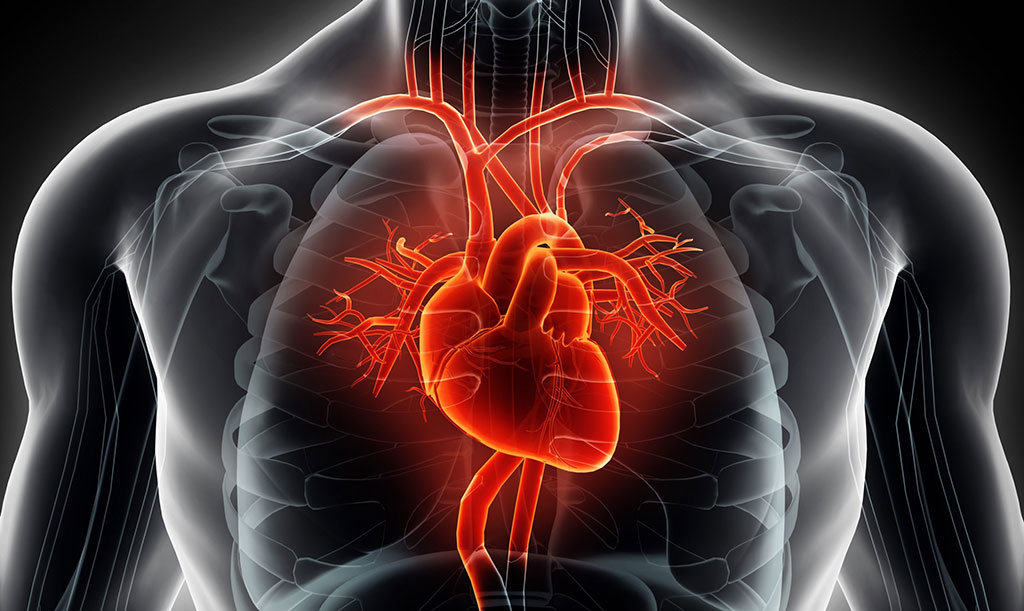 Image: Early CMR can help identify broken hearts (Photo courtesy of Getty Images)