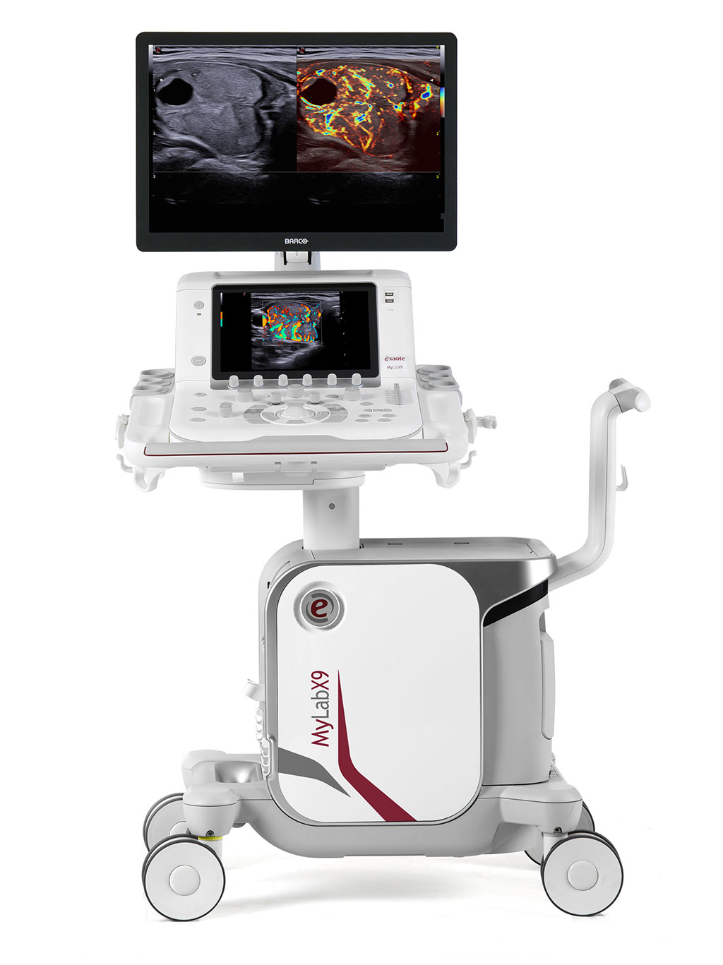 Image: The MyLab X9 64-bit X ULTRA ultrasound system (Photo courtesy of Esaote)