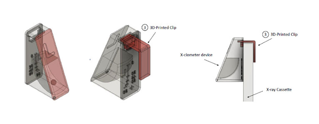 Image: The X-clometer resolves relative angulation of an x-ray (Photo courtesy of NIH)