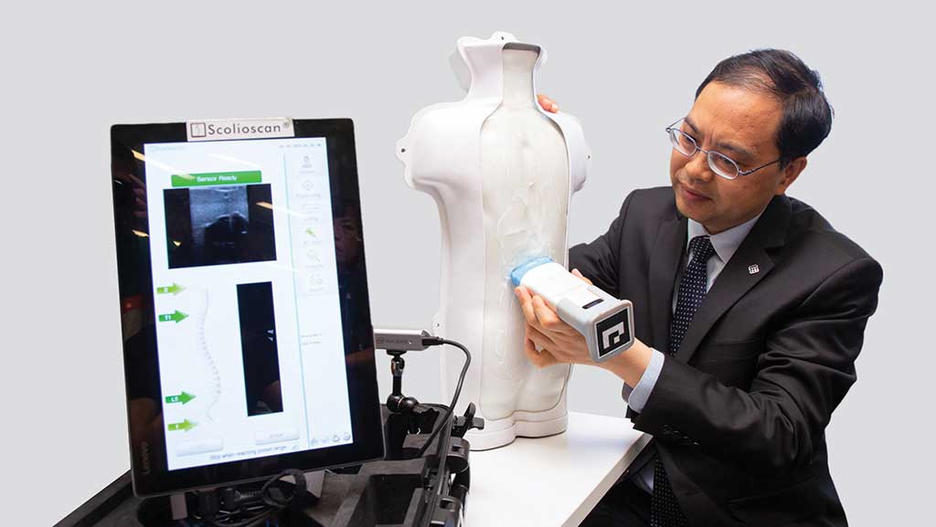 Image: The Scolioscan device used for ultrasound screening in Hong Kong (Photo courtesy of PolyU)