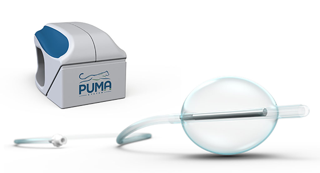 Image: The PUMA-G external and balloon magnets (Photo courtesy of CoapTech)