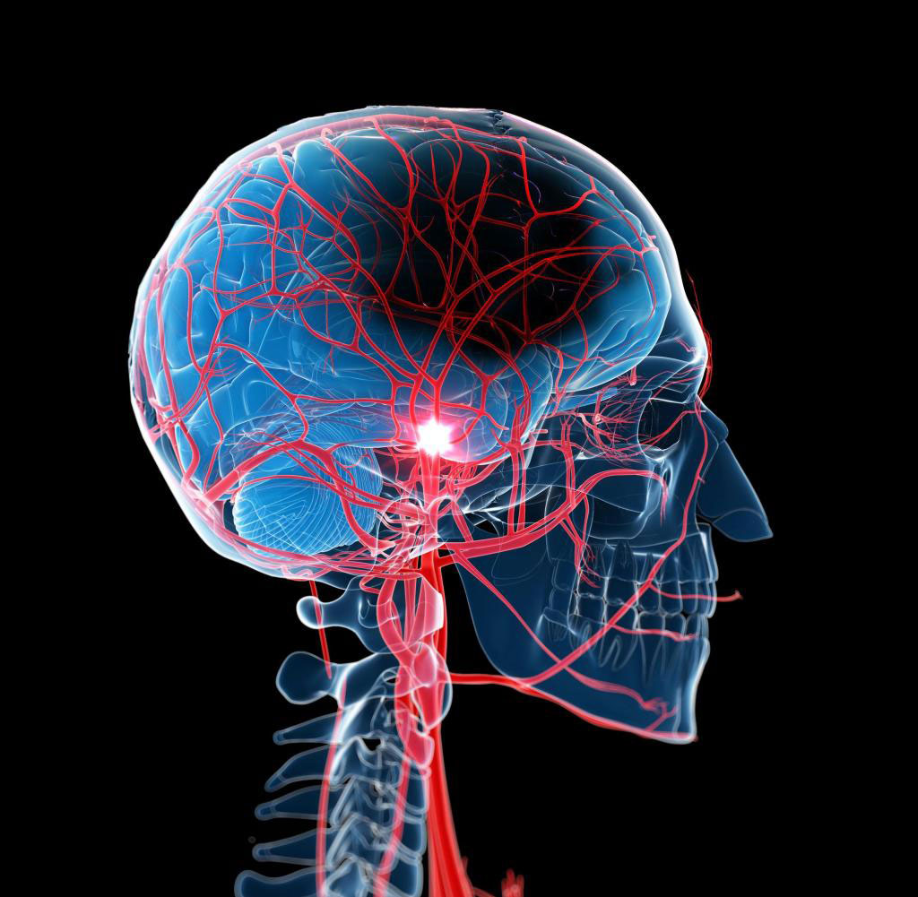 Image: Novel nanowire sensors detect cerebral blood flow non-invasively (Photo courtesy of Getty Images)