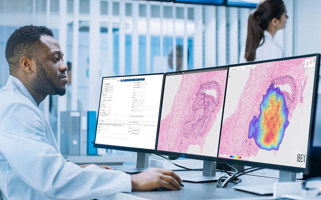 Image: The Galen Gastric AI-based pathology system (Photo courtesy of Ibex)