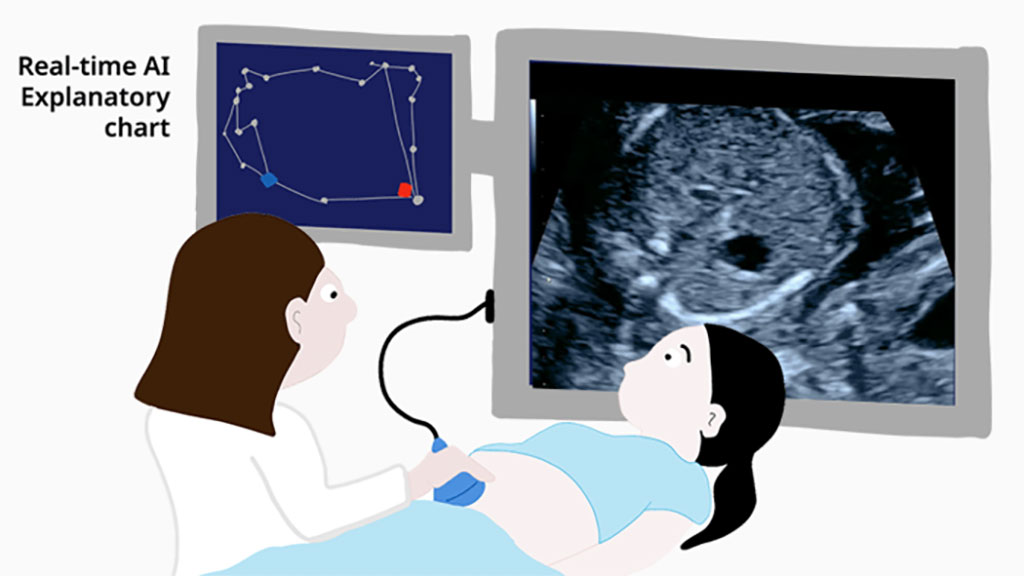 Image: Doctors used explanatory AI to screen ultrasound videos for fetal heart problems (Photo courtesy of RIKEN)