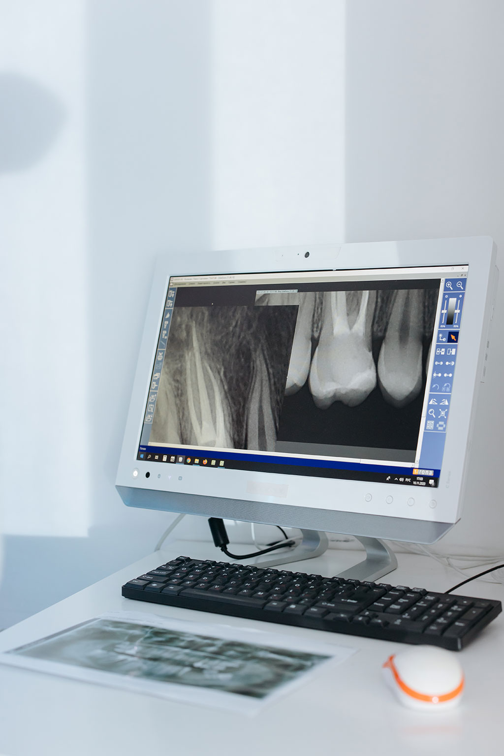 Image: An AI model can automatically diagnose osteoporosis from hip X-rays (Photo courtesy of Pexels)