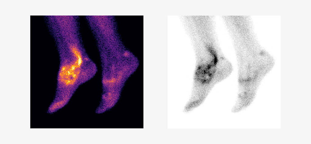 Image: 99mTc-maraciclatide planar imaging has the capacity to image the whole body (Photo courtesy of Serac Healthcare)