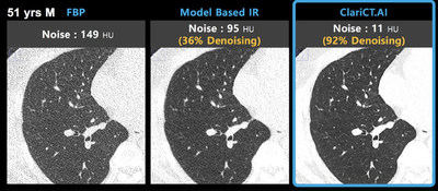 Image demonstration of ClariCT.AI (Photo courtesy of ClariPi)