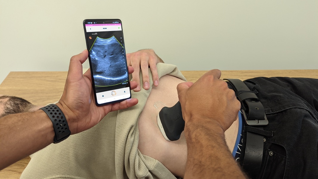 Image: The AI innovation in ultrasound addresses huge unmet clinical needs in liver disease (Photo courtesy of Oncoustics)