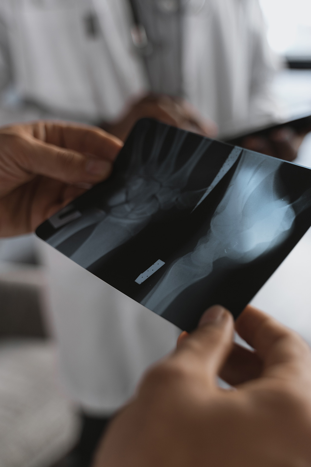 Image: AI algorithm can help to avoid missed fractures on whole-body trauma CT exams (Photo courtesy of Pexels)