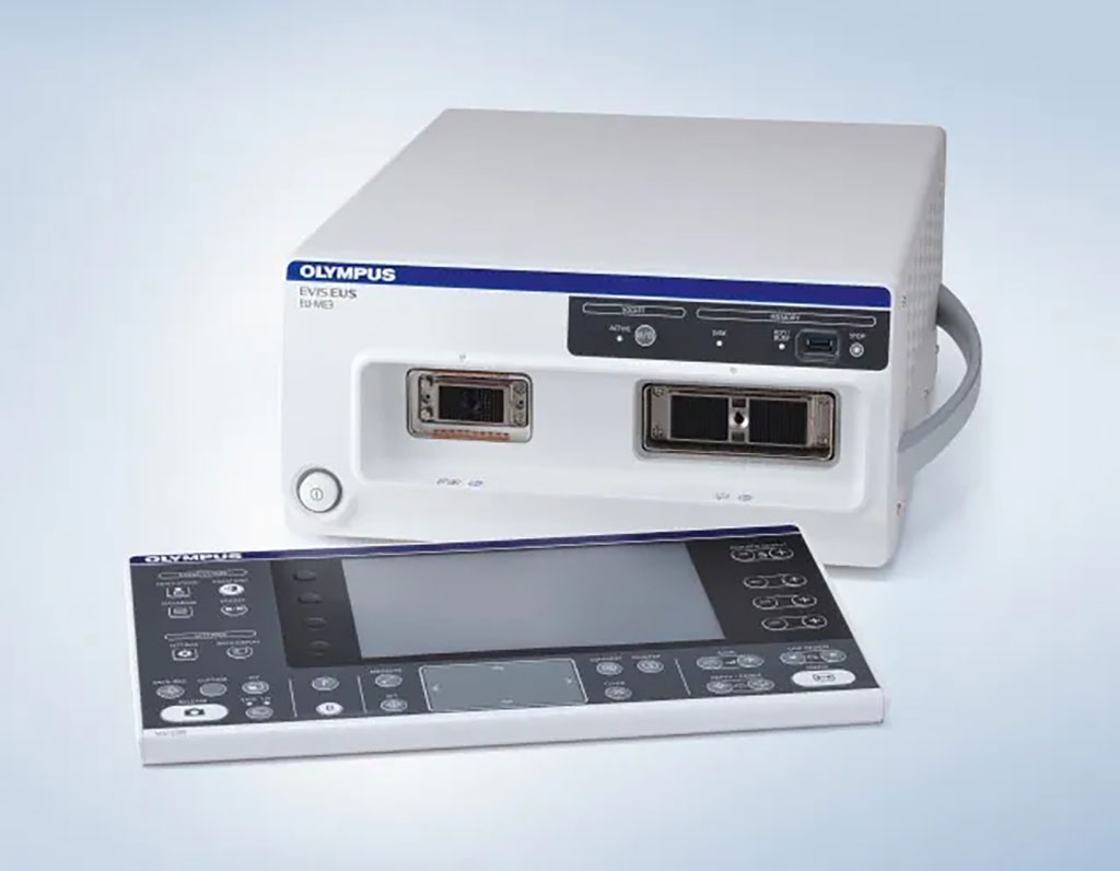 Image: The EU-ME3 ultrasound processor delivers higher resolution images for endoscopic ultrasound (Photo courtesy of Olympus)