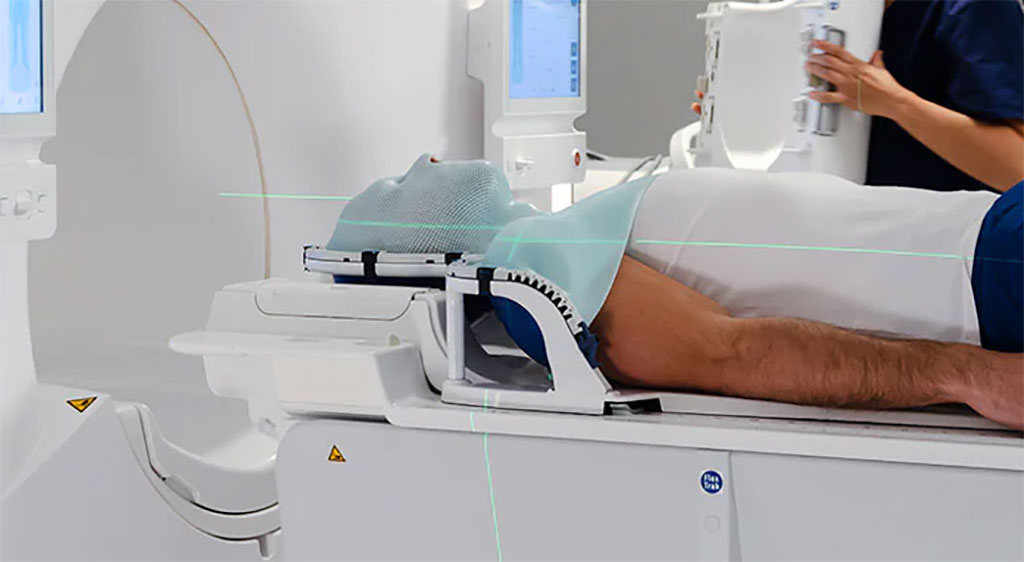 Image: MacroMedics mask being used in radiotherapy (Photo courtesy of Philips)