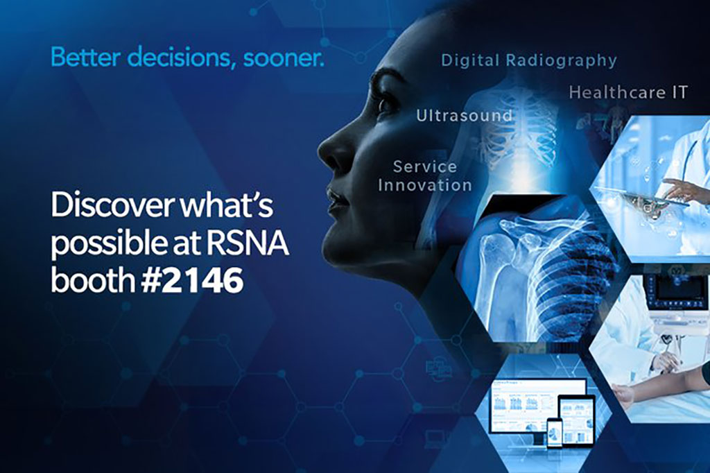 Image: Award-winning DR systems with DDR and AeroDR lightweight glassless FPDs are on display at RSNA 2022 (Photo courtesy of Konica)