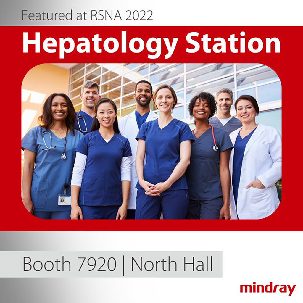 Image: Mindray is featuring its new “Hepatology Solutions” station at RSNA 2022 (Photo courtesy of Mindray)