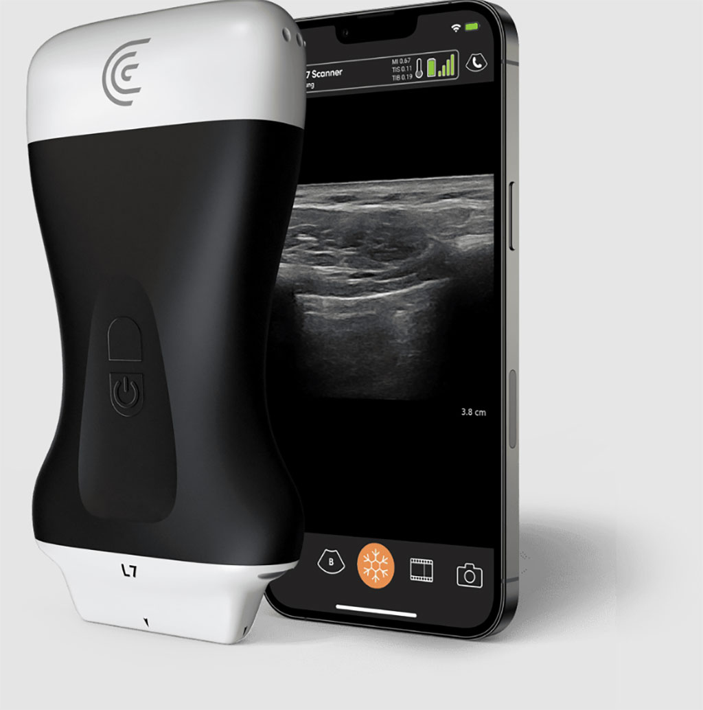 Image: The new Clarius MSK AI model speeds up diagnosis and treatment of musculoskeletal injuries (Photo courtesy of Clarius)