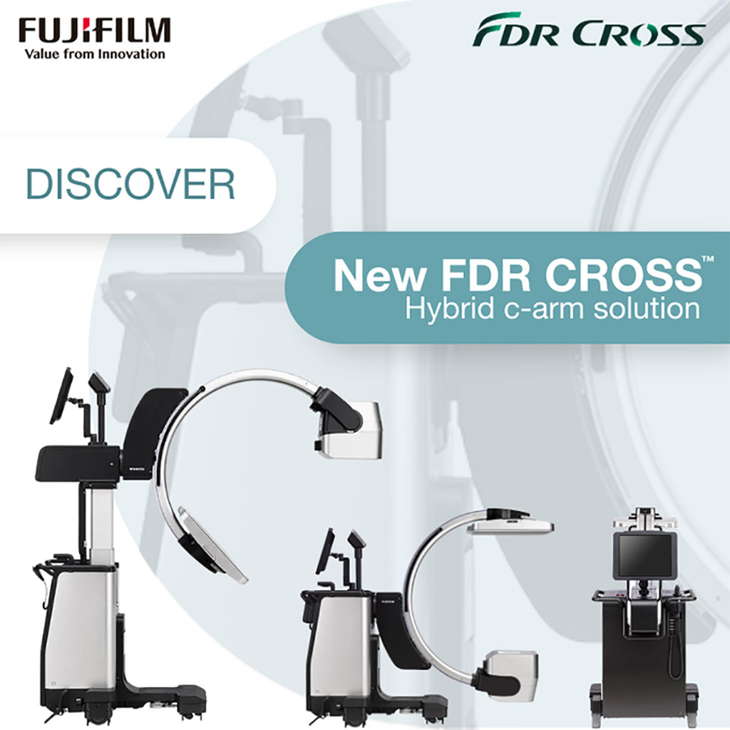 Image: The new FDR Cross Hybrid C-arm, a flexible, hybrid C-arm and portable X-ray machine system are on display at ECR 2023 (Photo courtesy of FUJIFILM)