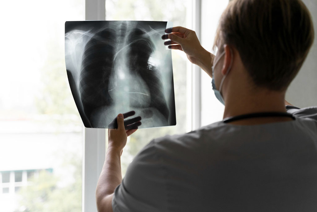 Image: Deep learning could better guide clinical decision-making in patients with pneumonia (Photo courtesy of Freepik)