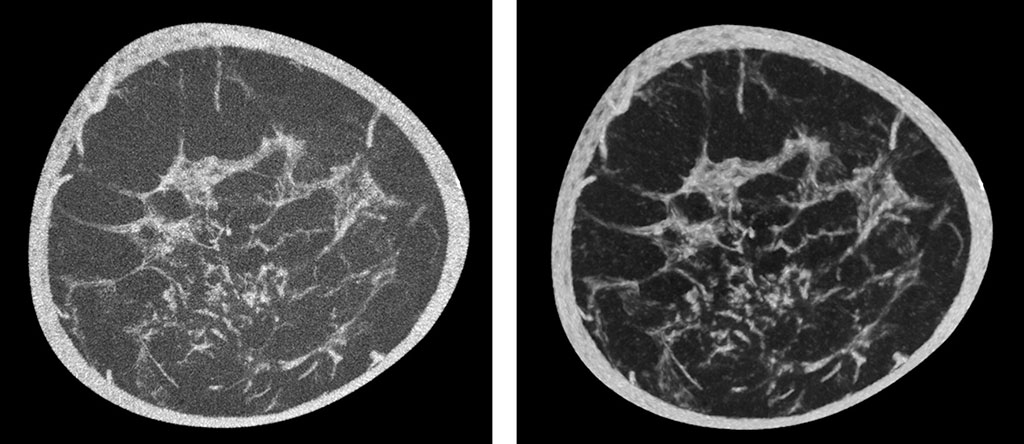 Image: Left - before use of Koning AI software, right - with use of Koning AI software (Photo courtesy of Koning)