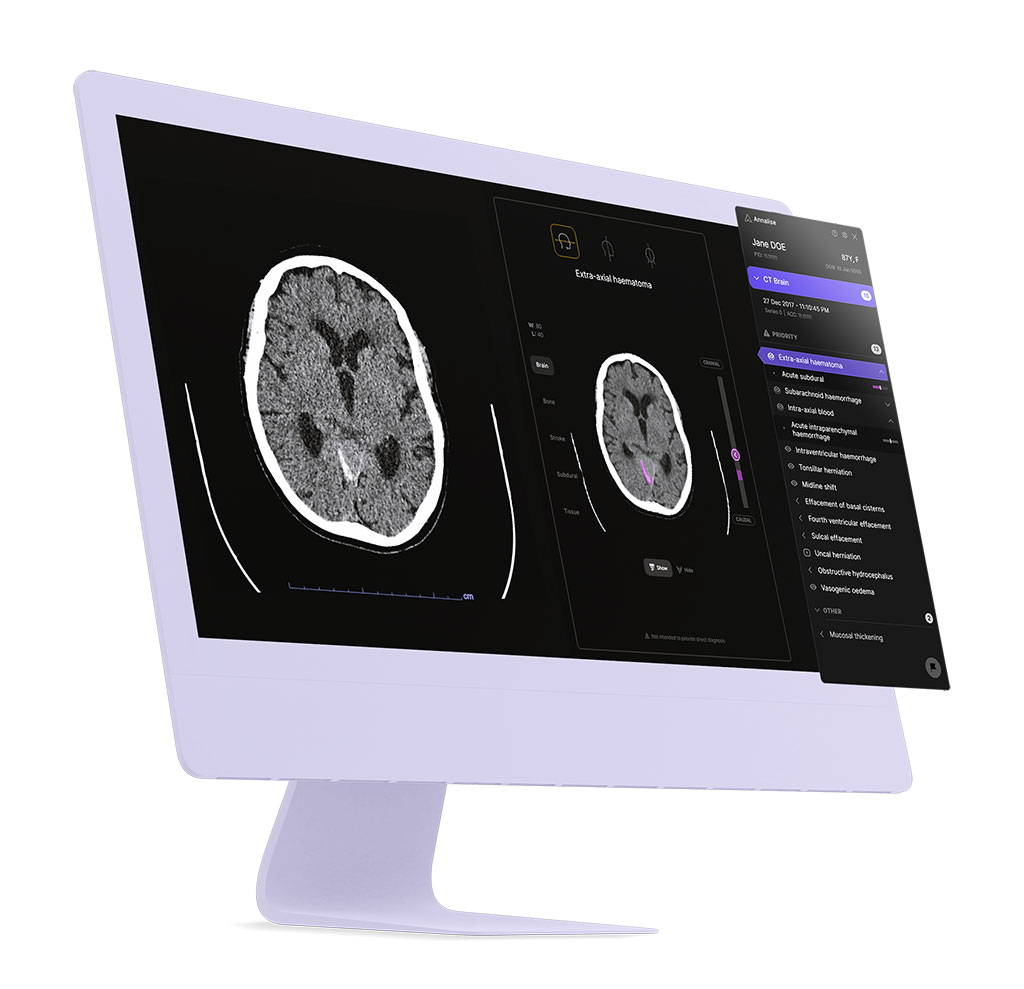 Image: The first ever radiology triage device has been awarded FDA Breakthrough Devices Designation (Photo courtesy of Annalise.ai)