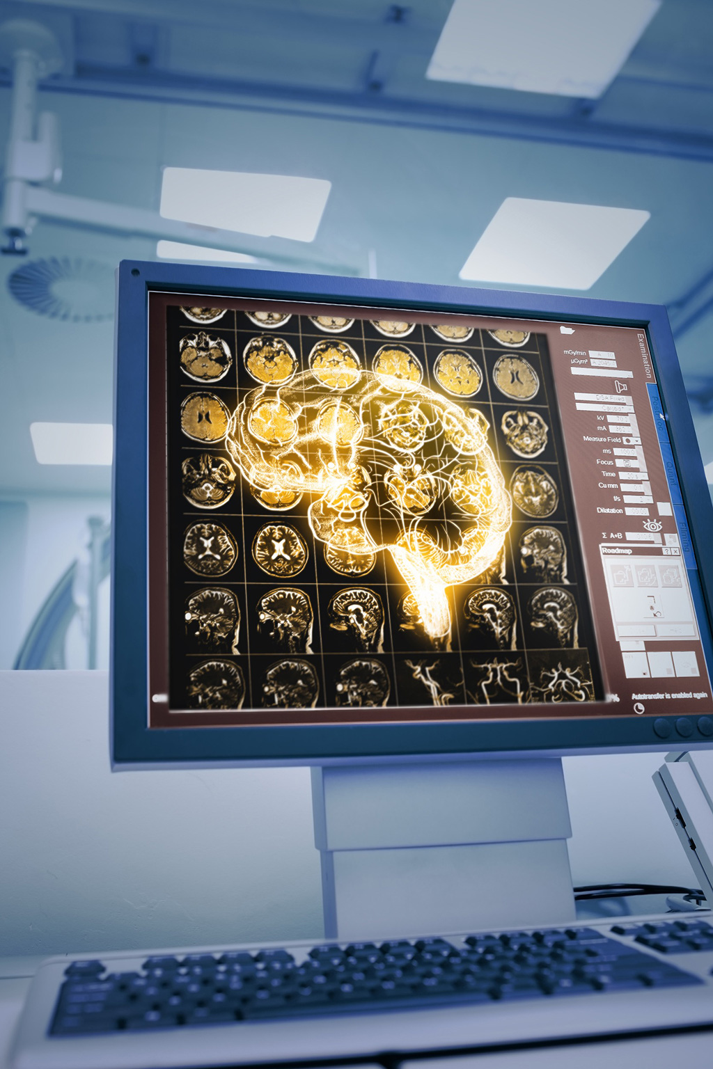 Image: An AI-powered algorithm can help detect unruptured brain aneurysms missed in routine clinical care (Photo courtesy of 123RF)