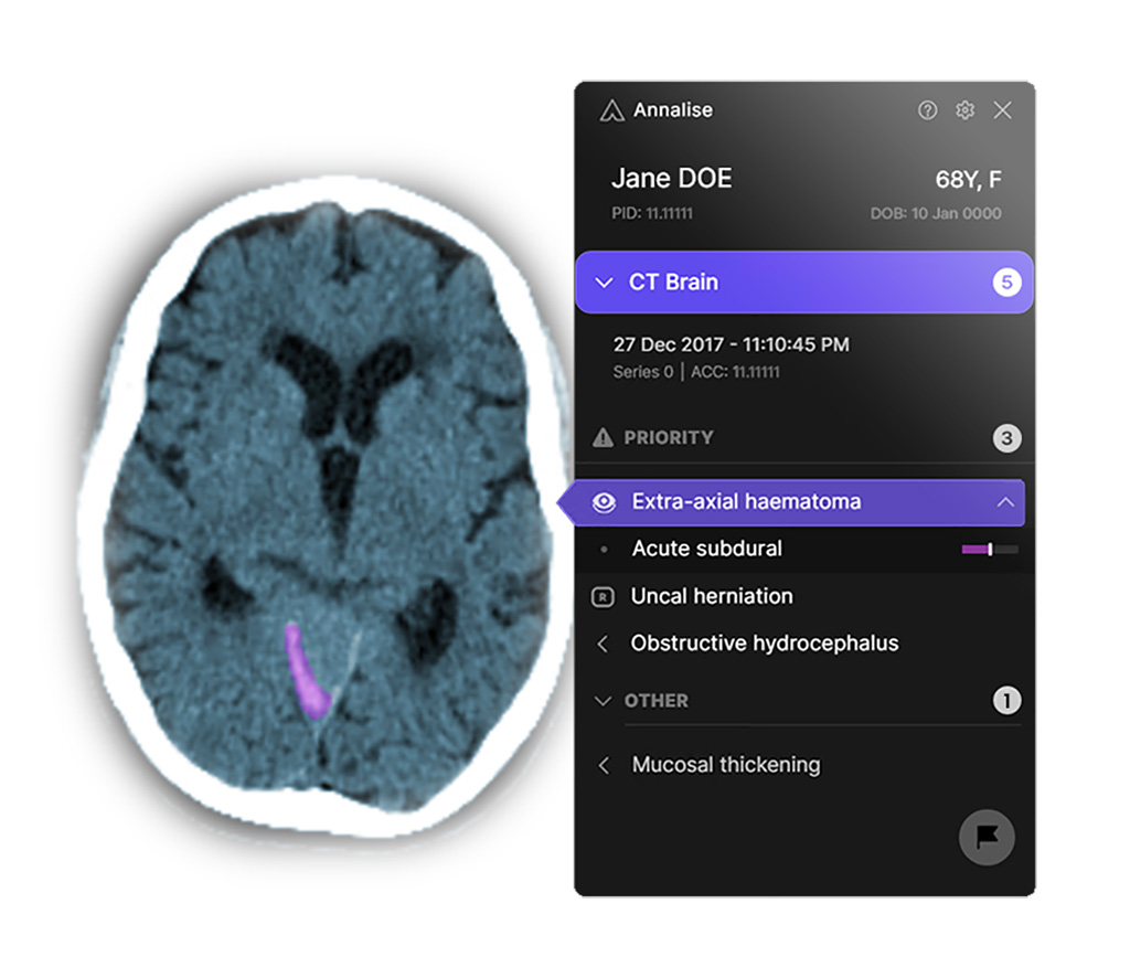 Image: Annalise Enterprise CTB acts like a ‘second pair of eyes’ for radiologists (Photo courtesy of Annalise.ai)