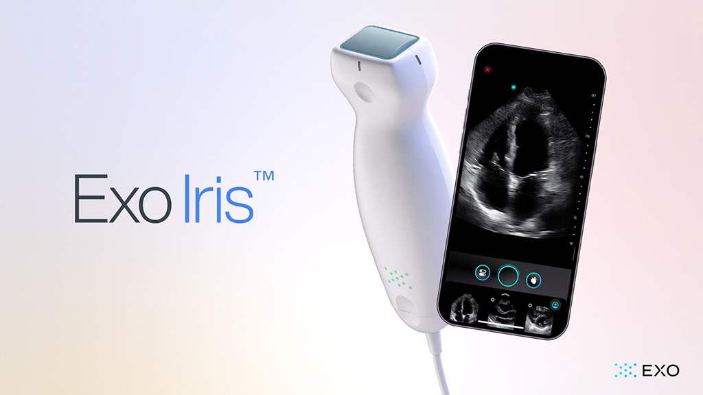 Image: The Exo Iris handheld ultrasound system (Photo courtesy of Exo)