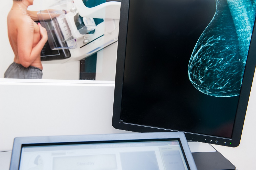 Image: Synthetic mammography is an image reconstruction technique that artificially creates a 2D image based on existing DBT data sets (Photo courtesy of 123RF)