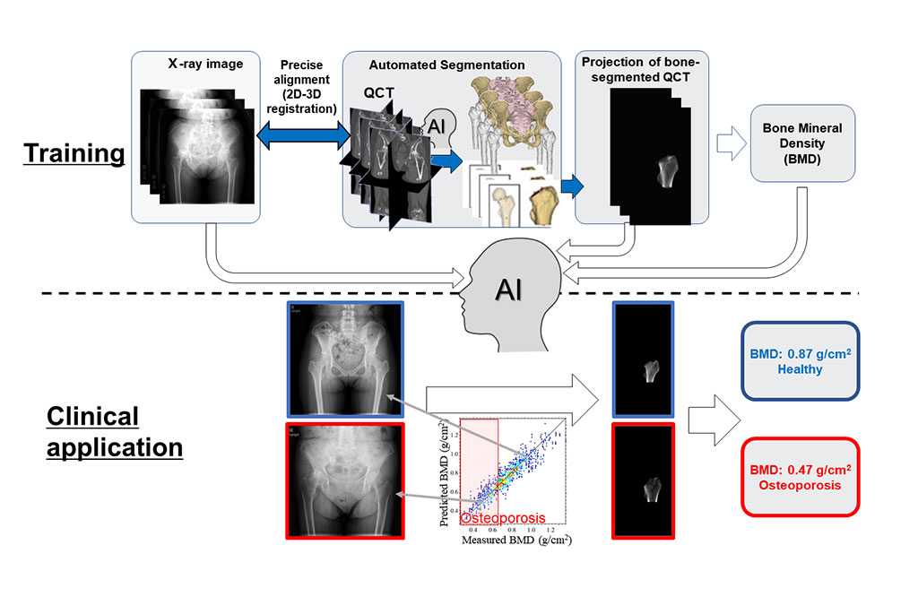 Image: An overview of the proposed method (Photo courtesy of NAIST)