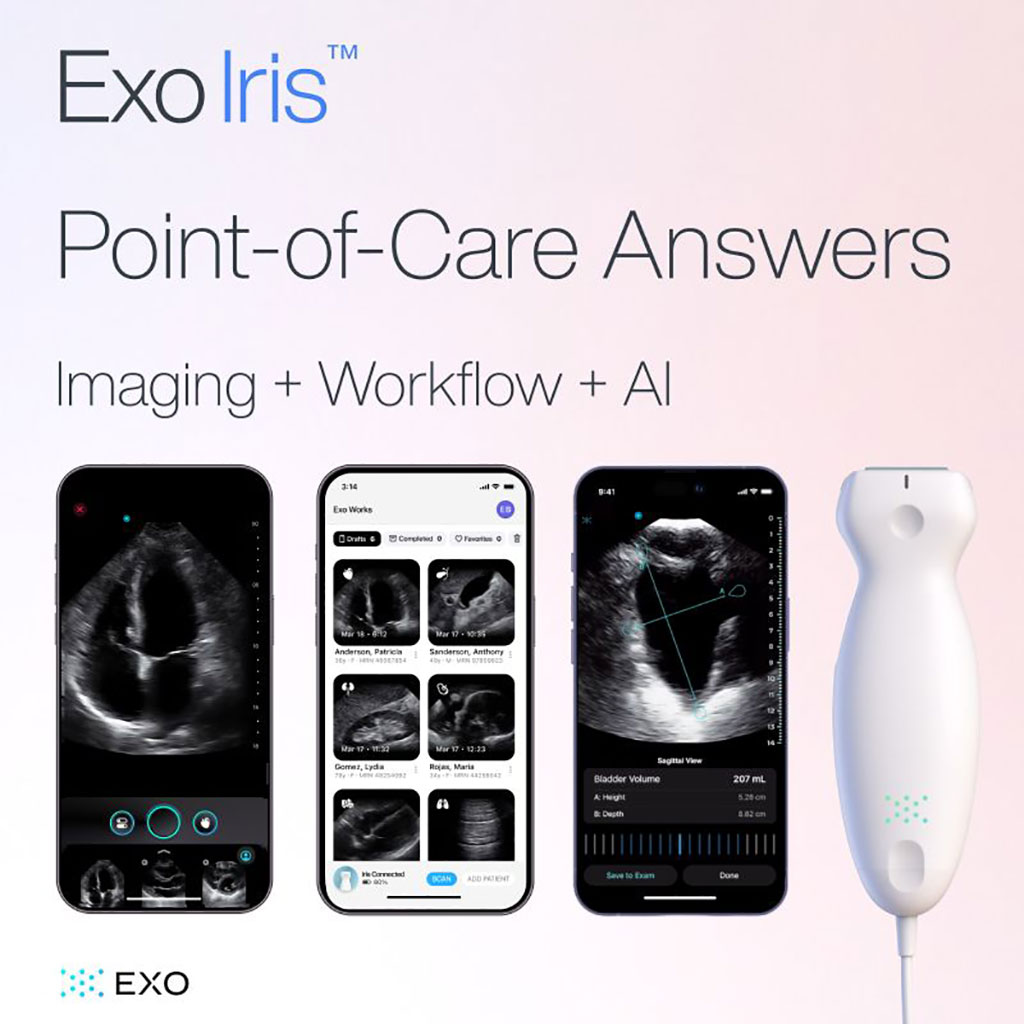 Image: The survey offers insights into point-of-care ultrasound expansion into hospitals and primary care (Photo courtesy of Exo)