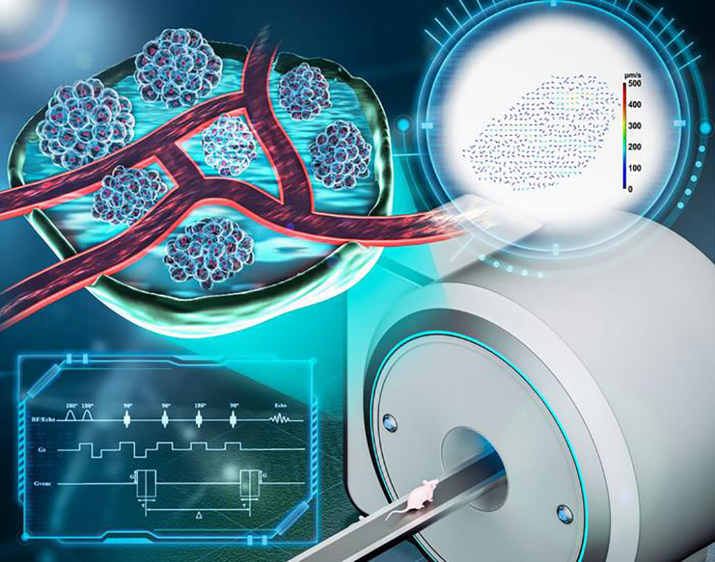 Image: MRI has the potential to determine interstitial fluid flow velocity non-invasively (Photo courtesy of NCNST)
