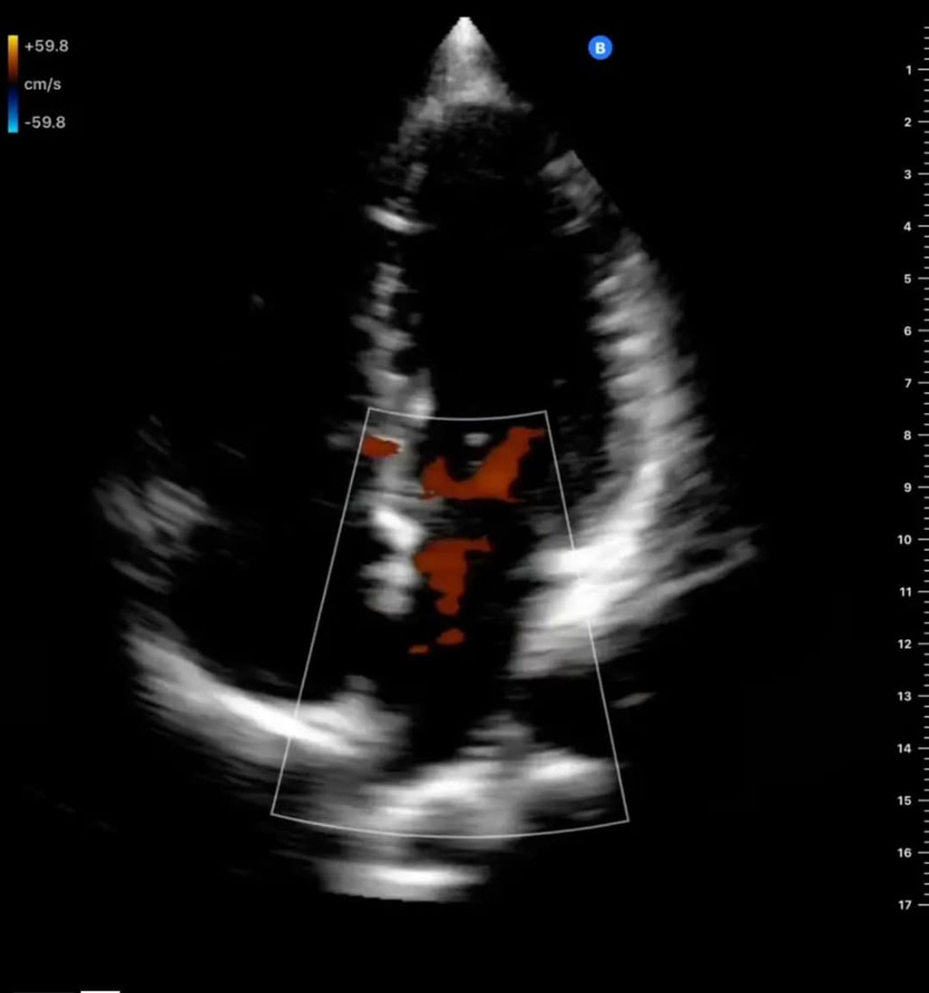 Image: A next-generation interventional robotic system will be powered by Butterfly`s Ultrasound-on-Chip technology (Photo courtesy of Butterfly Network)