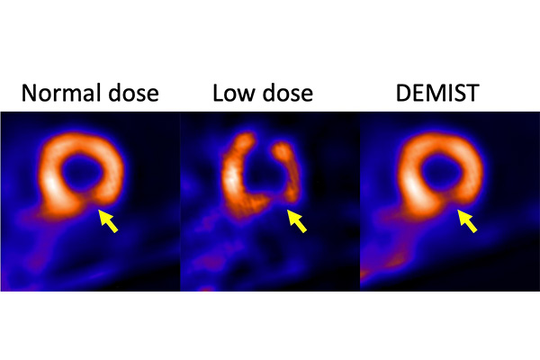 Image: The denoised image is less noisy and the defect is more detectable and visually clearer with DEMIST (Photo courtesy of Abhinav Jha/WUSTL)