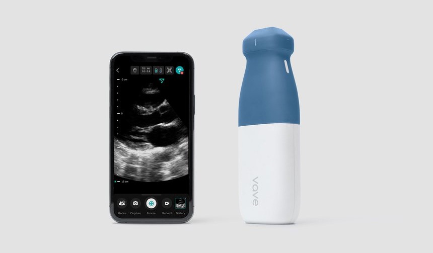 Image: The Vave Universal Probe (Photo courtesy of Vave Health)