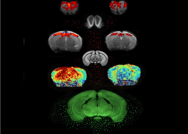 Image: In brains of control mice (left) and PD mice (right), from bottom to top: neuronal activity in a representative animal (Photo courtesy of Ruxanda Lungu/FC) Image: In brains of control mice (left) and PD mice (right), from bottom to top: neuronal activity in a representative animal (Photo courtesy of Ruxanda Lungu/FC)
