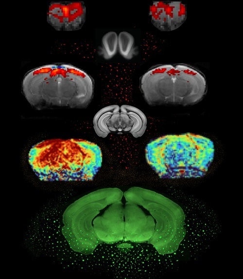 Image: In brains of control mice (left) and PD mice (right), from bottom to top: neuronal activity in a representative animal (Photo courtesy of Ruxanda Lungu/FC) Image: In brains of control mice (left) and PD mice (right), from bottom to top: neuronal activity in a representative animal (Photo courtesy of Ruxanda Lungu/FC)