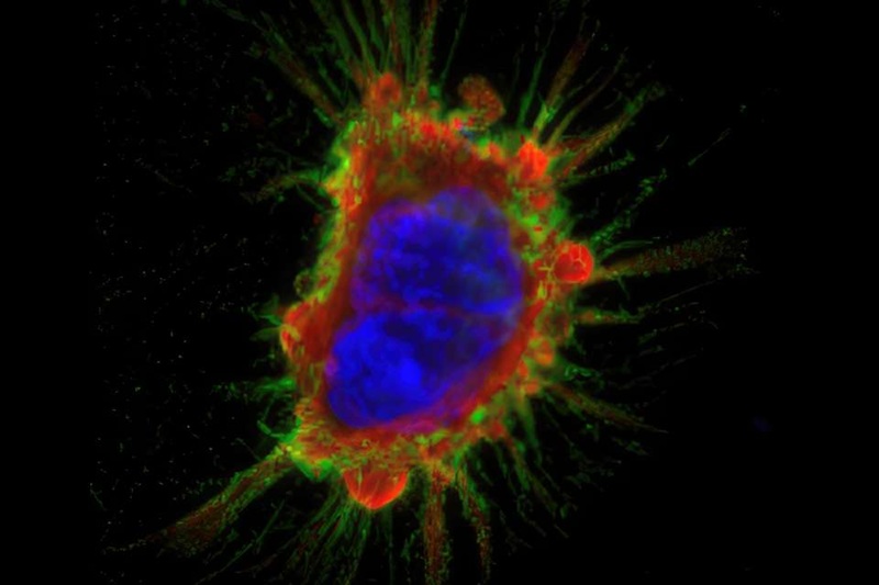 Image: A bone cancer cell showing supportive fibers (in red), genetic material (in blue), and the specific target protein LRRC15 (in green) (Photo courtesy of Ulmert Laboratory)