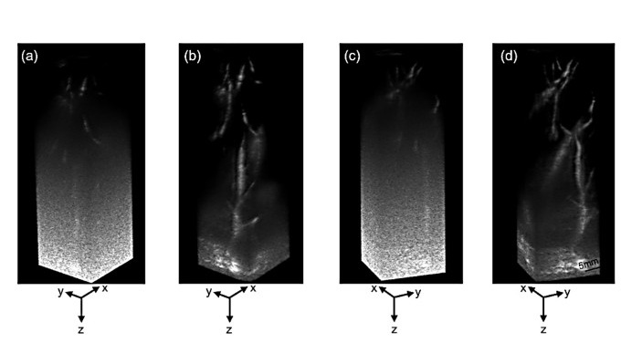 Image: Real-time vascular images of the human renal-splenic region obtained using an RCA transducer (Photo courtesy of DGIST) Image: Real-time vascular images of the human renal-splenic region obtained using an RCA transducer (Photo courtesy of DGIST)
