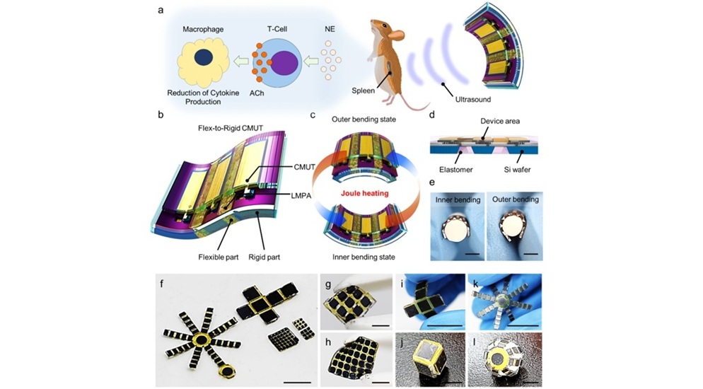 Image: The flex-to-rigid wearable ultrasound sensor maintains high acoustic power for imaging and treatment (Lee, SM., Liang, X., Jo, Y. et al. npj Flex Electron 9, 107 (2025). DOI: 10.1038/s41528-025-00484-7) Image: The flex-to-rigid wearable ultrasound sensor maintains high acoustic power for imaging and treatment (Lee, SM., Liang, X., Jo, Y. et al. npj Flex Electron 9, 107 (2025). DOI: 10.1038/s41528-025-00484-7)